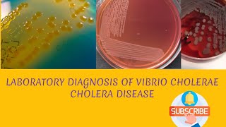 Laboratory diagnosis of Vibrio cholerae in hindi [upl. by Ayotel]