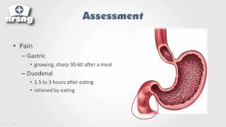 PUD Peptic Ulcer Disease Nursing NCLEX® Review  NRSNGacademycom [upl. by Ratcliff]