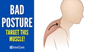 Quickly Fix Bad Posture By Releasing This Tight Muscle [upl. by Doowle]