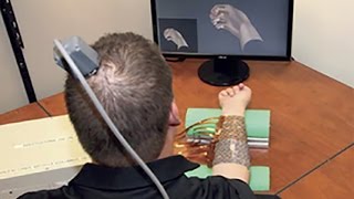 Neural bypass system restores movement in quadriplegic patient [upl. by Ecital]