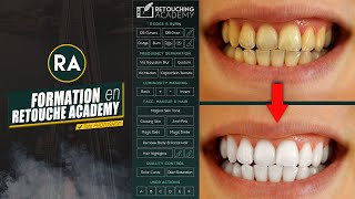 Retouche Academy Comment blanchir les dents sur Photoshop [upl. by Fatma328]