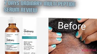 The Ordinary Multipeptide Serum for hair density 7 day review [upl. by Ahsuatan]