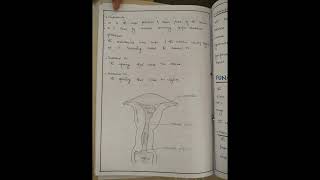 cervical cancer nursing care plan on cervical cancer NCP [upl. by Kerwinn]