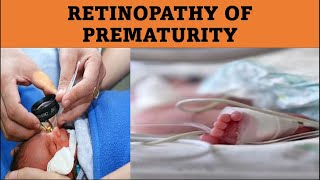 What Causes ROP  Retinopathy of prematurity [upl. by Esilana]