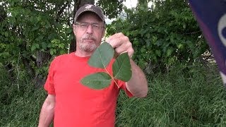 How to never have a serious poison ivy rash again [upl. by Slein]