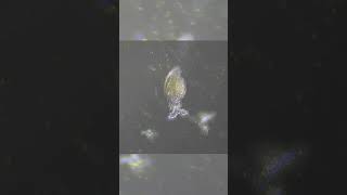 Rotifer is a magnificent creature microscopy shorts [upl. by Swigart]