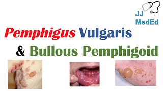 Vesiculobullous Skin Diseases  Pemphigus Vulgaris vs Bullous Pemphigoid [upl. by Langdon]