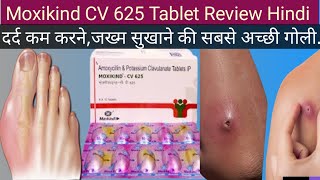 Moxikind cv 625 Tablet ke Fayde Moxikind cv 625 Tablet Uses in Hindi Antibiotics Tablet [upl. by Elle702]