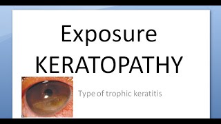 Ophthalmology 124 a Exposure KERATOPATHY Keratitis Causes Corneal Dry [upl. by Ahsoem366]