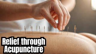 The Life Of A Acupuncturist [upl. by Aicinad]