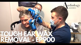 TOUGH EAR WAX REMOVAL IT TOOK BOTH OF US TO REMOVE   EP900 [upl. by Mindi]