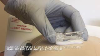 Removal gripper plus needle [upl. by Enilesoj]