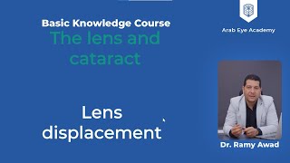 Lecture 10 The Lens amp Cataract Part 2 Lens displacement and Aphakia [upl. by Torhert]