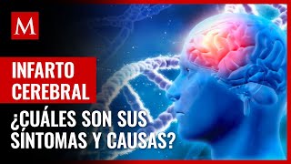 ¿Hay síntomas ¿Qué es un infarto cerebral y cuáles son sus posibles causas [upl. by Saleem921]