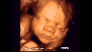 Vídeo de Ecografia 4D de un bebé de 29 semanas [upl. by Chladek]