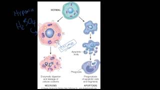 4  Introduction to Pathology  Necrosis vs Apoptosis [upl. by Harberd]