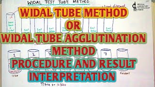 Widal test tube or tube agglutination or tube titration methodprocedure and result interpretation [upl. by Ylerebmik]