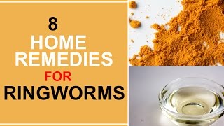 8 Home Remedies For Ringworms [upl. by Nylorak]