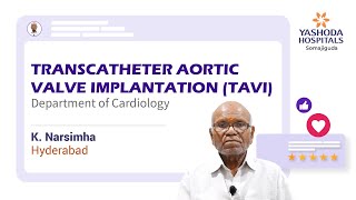 Transcatheter Aortic Valve Implantation TAVI  Severe Aortic Stenosis [upl. by Huston135]