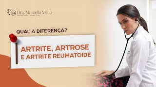 ARTRITE ARTROSE OU ARTRITE REUMATOIDE [upl. by Aerdua]