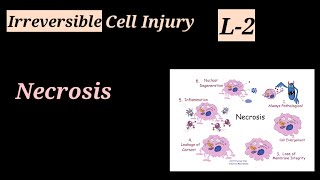 General Pathology  IRREVERSIBLE CELL INJURY— NECROSIS L2  mbbs2ndyear gabavibes07 pathology [upl. by Nedak]