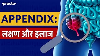 Appendix What Are Symptoms of Appendicitis  Appendicitis Treatment In Hindi  Practo [upl. by Noryv]