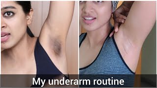 How I Got Rid of My Dark Underarms [upl. by Goldshlag]