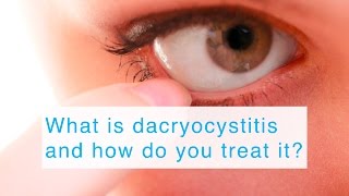 What is dacryocystitis and how do you treat it [upl. by Enyak790]