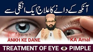 Wazifa for eye Problem  Wazifa for eye pimple  Ankh ke Dane ka amal [upl. by Sugar]