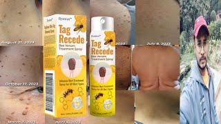 Flysmus Tag Recede Bee Venom Treatment Spray  Honest Review [upl. by Range]