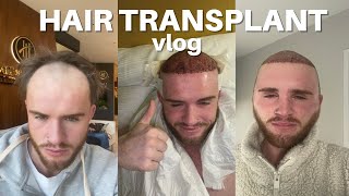 I GOT A HAIR TRANSPLANT IN TURKEY  VLOG [upl. by Farr]