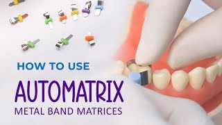 How to use Automatrix Metal Band Matrices [upl. by Hnacogn]