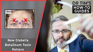 New Glabella Botulinum Toxin Pattern [upl. by Mcfarland]