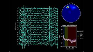 EEG GUI [upl. by Irab]