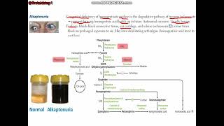 Maple syrup urine disease Alkaptonuria [upl. by Norel]