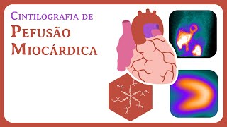 Cintilografia de Perfusão Miocárdica [upl. by Merari]