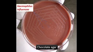 Haemophilus influenzae colony Morphology on Chocolate agar [upl. by Eiclek214]