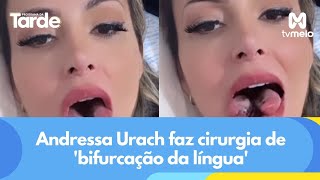 Andressa Urach faz cirurgia de bifurcação da língua [upl. by Quarta]