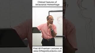 Clinical Features Of Intracranial Haemorrhages shortvideo shorts drnajeeb drnajeeblectures [upl. by Nylrahc]