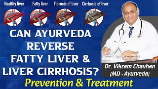 Can Ayurveda Reverse Fatty Liver amp Liver Cirrhosis Prevention amp Treatment by Dr Vikram Chauhan [upl. by Nolak]