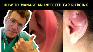 How to recognise manage and treat an infected ear piercing  Doctor ODonovan explains [upl. by Evania]