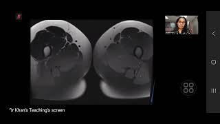 DKT GYNAE AND OBS PART 1 [upl. by Nivac]