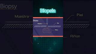 BIOPSIA  DEFINICIÓN MÉDICA  Interpretación Consecutiva [upl. by Ecinnej]