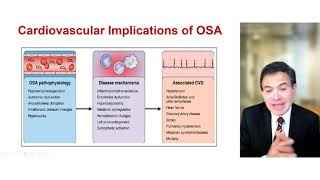 StateoftheArt Sleep Apnea and Cardiovascular Disease [upl. by Doe]