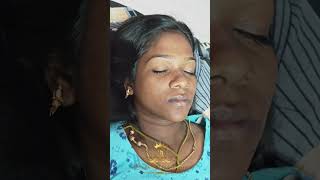 hydrafacialtreatment chennai [upl. by Ermine]