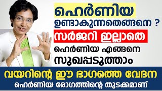 ഹെർണിയ രോഗം ഉണ്ടാകുന്നതെങ്ങനെ  സർജറി ഇല്ലാതെ Hernia എങ്ങനെ സുഖപ്പടുത്താം  Hernia Malayalam [upl. by Lhamaj]