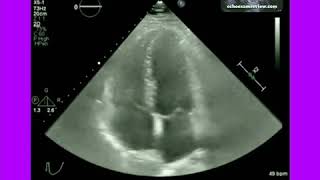 Echocardiography [upl. by Esenahs]