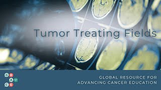 Tumor Treating Fields An Overview Mesothelioma and Glioblastoma 2024 [upl. by Eked]