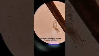 Microscopic examination of Demodex folliculorum in hair follicles [upl. by Balthasar133]