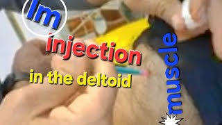 IM injection technique in Deltoid muscle [upl. by Atiruam]